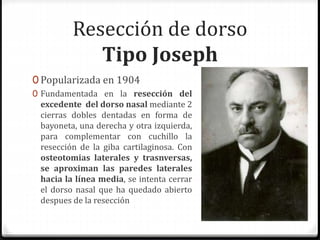 Resección de dorso
Tipo Joseph
0 Popularizada en 1904
0 Fundamentada en la resección del
excedente del dorso nasal mediante 2
cierras dobles dentadas en forma de
bayoneta, una derecha y otra izquierda,
para complementar con cuchillo la
resección de la giba cartilaginosa. Con
osteotomias laterales y trasnversas,
se aproximan las paredes laterales
hacia la línea media, se intenta cerrar
el dorso nasal que ha quedado abierto
despues de la resección
 