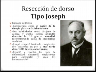 Resección de dorso
Tipo Joseph
0 Cirujano de Berlín
0 -Considerado como el padre de la
cirugía plástica facial moderna
0 -Sus habilidades como cirujano de
cabeza y cuello fueron afinadas
durante la 1ª guerra mundial,
reconstruyendo caras de incontables
soldados.
0 -Joseph empezó haciendo rinoplastias
con incisiones en piel y mas tarde
desarrolló la técnica intranasal
0 -Estudió y clasificó los tipos de
deformidad, desarrolló operaciones
para corregirlas y creo los
instrumentales
 
