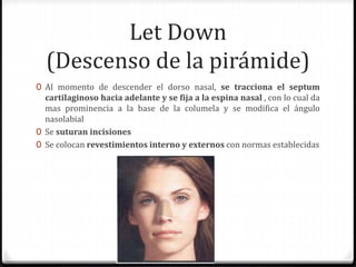 Let Down
(Descenso de la pirámide)
0 Al momento de descender el dorso nasal, se tracciona el septum
cartilaginoso hacia adelante y se fija a la espina nasal , con lo cual da
mas prominencia a la base de la columela y se modifica el ángulo
nasolabial
0 Se suturan incisiones
0 Se colocan revestimientos interno y externos con normas establecidas
 