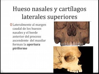 Hueso nasales y cartílagos
laterales superiores
0 Lateralmente al margen
caudal de los huesos
nasales y el borde
anterior del proceso
ascendente del maxilar
forman la apertura
piriforme
 