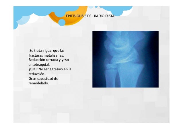 El preparado del hongo de las uñas en los pies para los niños