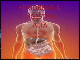 HEMORRAGIA
DIGESTIVA
ALTA
 