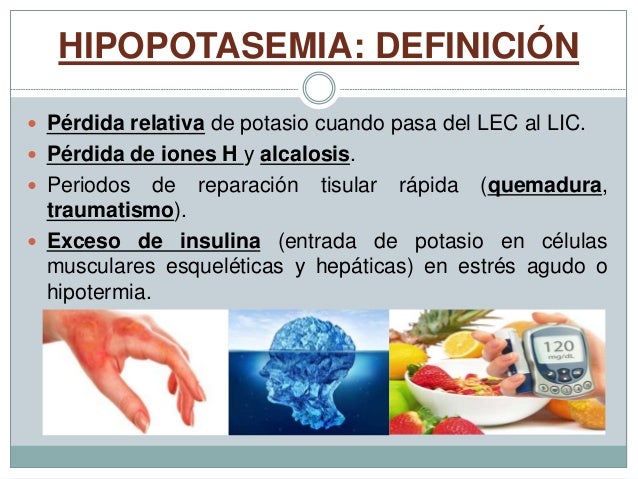 CIENCIA Imagen hipopotasemia
