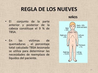 REGLA DE LOS NUEVES
                                   NIÑOS
• El    conjunto de la parte
  anterior y posterior de la
  cabeza constituye el 9 % de
  TBSA.

• En      las    victimas     de
  quemaduras , el porcentaje
  total calculado TBSA lesionada
  se utiliza para determinar las
  necesidades de reemplazo de
  líquidos del paciente.


                                           20
 