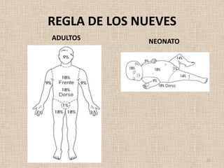 REGLA DE LOS NUEVES
ADULTOS       NEONATO




                        21
 