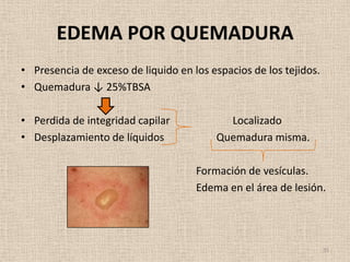 EDEMA POR QUEMADURA
• Presencia de exceso de liquido en los espacios de los tejidos.
• Quemadura ↓ 25%TBSA

• Perdida de integridad capilar            Localizado
• Desplazamiento de líquidos             Quemadura misma.

                                     Formación de vesículas.
                                     Edema en el área de lesión.




                                                                   35
 
