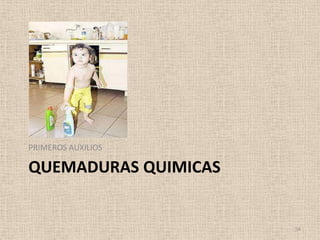 PRIMEROS AUXILIOS

QUEMADURAS QUIMICAS


                      54
 