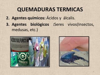 QUEMADURAS TERMICAS
2. Agentes químicos: Ácidos y álcalis.
3. Agentes biológicos :Seres vivos(Insectos,
   medusas, etc.)




                                           6
 