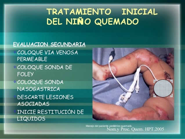 Gran Quemado Pediátrico | PAE de paciente pediátrico quemado final – PWMV