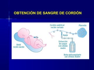 OBTENCIÓN DE SANGRE DE CORDÓN
 