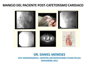 MANEJO DEL PACIENTE POST-CATETERISMO CARDIACO
DR. DANIEL MENESES
JEFE HEMODINAMICA. HOSPITAL METROPOLITANO VIVIAN PELLAS
NOVIEMBRE 2012
 