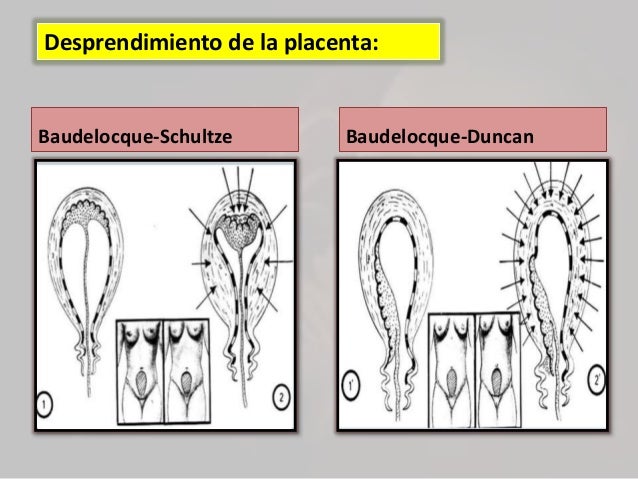 Manejo del trabajo del parto