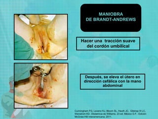 Hacer una tracción suave
del cordón umbilical
Después, se eleva el útero en
dirección cefálica con la mano
abdominal
MANIOBRA
DE BRANDT-ANDREWS
Cunningham FG, Leveno KJ, Bloom SL, Hauth JC, Gilstrap III LC,
Wenstrom KD. Obstetricia de Williams. 23 ed. México D.F.: Edición
McGraw-Hill Interamericana; 2011.
 