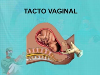 TACTO VAGINAL
 