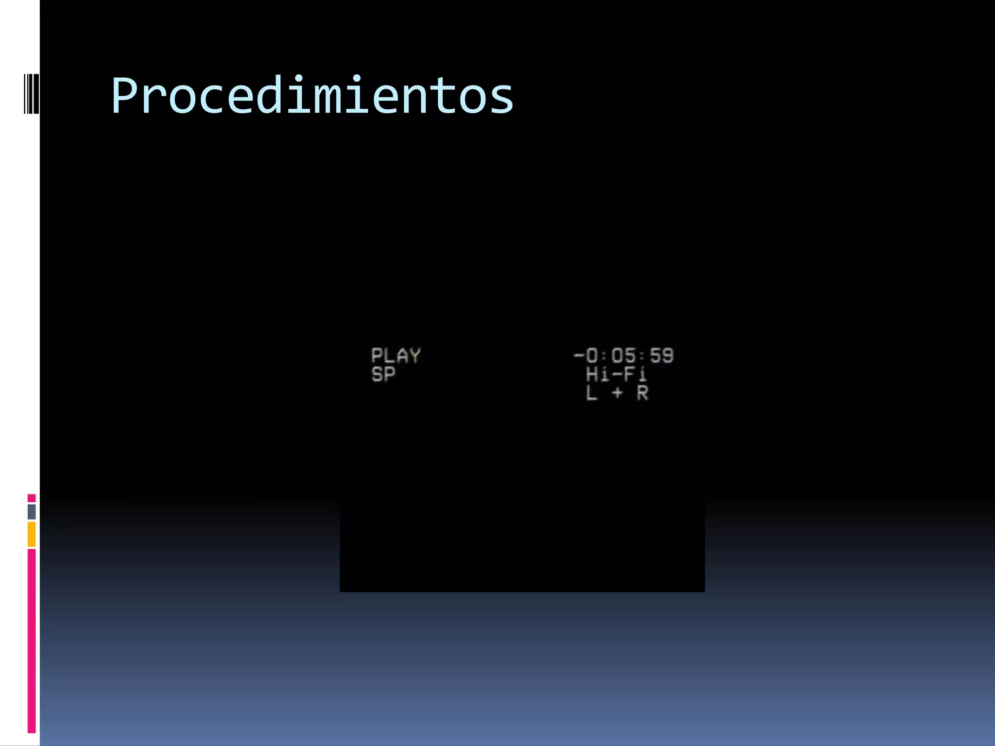 Procedimientos
 