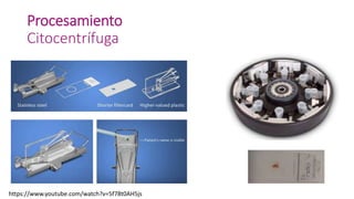 Procesamiento
Citocentrífuga
https://www.youtube.com/watch?v=5f78t0AH5js
 