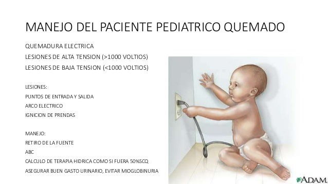 Manejo de quemaduras en el paciente pediatrico