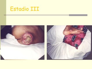 Estadio III 