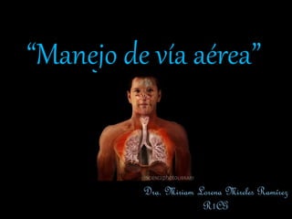 “Manejo de vía aérea”
Dra. Miriam Lorena Mireles Ramírez
R1CG
 