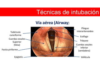 Técnicas de intubación Vía aérea (Airway)Pliegue interaritenoideoTubérculo cuneiformeEsófagoCuerdas vocales Superior (falsa)Tráquea Cuerdas vocales Inferior (verdadera)Fosita piriforme Epiglotis  Vallécula