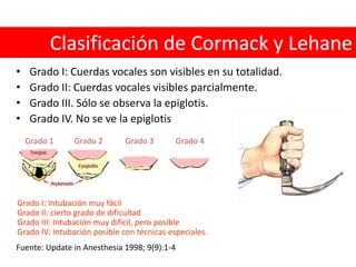 Distancia Interincisivos