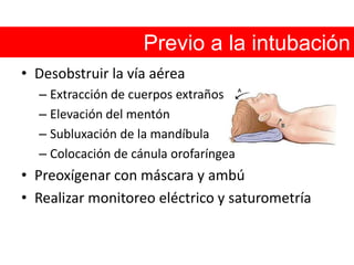 Previo a la intubación Desobstruir la vía aérea Extracción de cuerpos extraños Elevación del mentón Subluxación de la mandíbula Colocación de cánula orofaríngeaPreoxígenar con máscara y ambúRealizar monitoreo eléctrico y saturometría