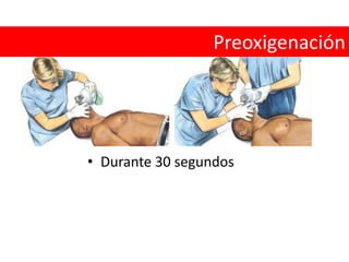 PreoxigenaciónDurante 30 segundos 