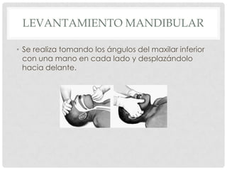 LEVANTAMIENTO MANDIBULAR
• Se realiza tomando los ángulos del maxilar inferior
con una mano en cada lado y desplazándolo
hacia delante.
 