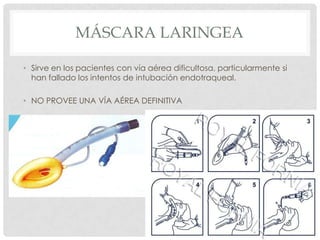MÁSCARA LARINGEA
• Sirve en los pacientes con vía aérea dificultosa, particularmente si
han fallado los intentos de intubación endotraqueal.
• NO PROVEE UNA VÍA AÉREA DEFINITIVA
 