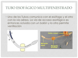TUBO ESOFÁGICO MULTIFENESTRADO
• Uno de los Tubos comunica con el esófago y el otro
con la vía aérea. La vía de acceso esofágico es
entonces ocluida con un balón y la otra permite
ventilación
 