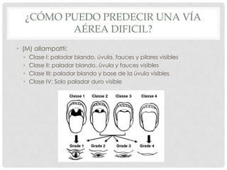 ¿CÓMO PUEDO PREDECIR UNA VÍA
AÉREA DIFICIL?
• (M) allampatti:
• Clase I: paladar blando, úvula, fauces y pilares visibles
• Clase II: paladar blando, úvula y fauces visibles
• Clase III: paladar blando y base de la úvula visibles
• Clase IV: Solo paladar duro visible
 