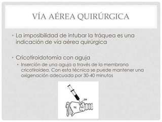 VÍA AÉREA QUIRÚRGICA
• La imposibilidad de intubar la tráquea es una
indicación de vía aérea quirúrgica
• Cricotiroidotomía con aguja
• Inserción de una aguja a través de la membrana
cricotiroidea. Con esta técnica se puede mantener una
oxigenación adecuada por 30-40 minutos
 