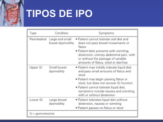TIPOS DE IPO 