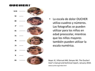 • La escala de dolor OUCHER
utiliza cuadros y números.
Las fotografías se pueden
utilizar para los niños en
edad preescolar, mientras
que los niños mayores
también pueden utilizar la
escala numérica.
Beyer JE, Villarruel AM, Denyes MJ. The Oucher!
User’s manual and technical report, January 2010.
www.oucher.org/index.html
 