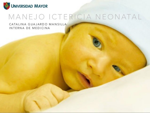 Resultado de imagen para ictericia neonatal