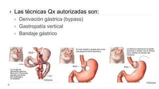  Las técnicas Qx autorizadas son:
 Derivación gástrica (bypass)
 Gastropatía vertical
 Bandaje gástrico
 