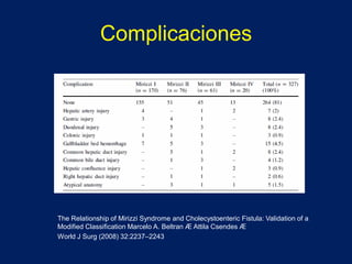MANEJO LAPAROSCÓPICO DEL SINDROME DE MIRIZZI CP-IHPBA | PDF