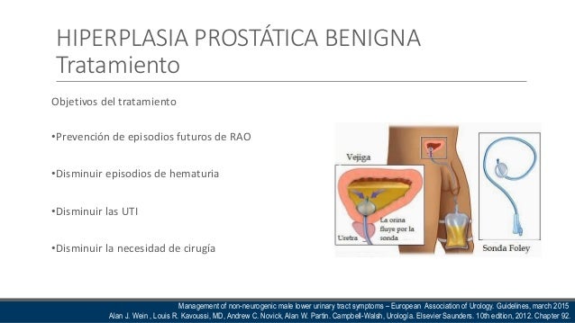 Manejo no quirurgico de la hiperplasia prostatica benigna