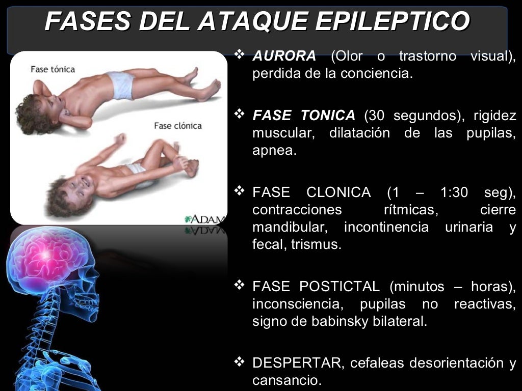 Ataque Epilético Como Socorrer - BRAINCP