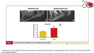 Subramanian S, et al. High-dose atorvastatin reduces periodontal inflammation: a novel pleiotropic effect of statins. J Am Coll Cardiol. 2013
Dec 24;62(25):2382-91
 