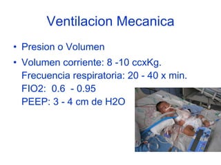 Ventilacion Mecanica Presion o Volumen Volumen corriente: 8 -10 ccxKg.  Frecuencia respiratoria: 20 - 40 x min.  FIO2:  0.6  - 0.95  PEEP: 3 - 4 cm de H2O  