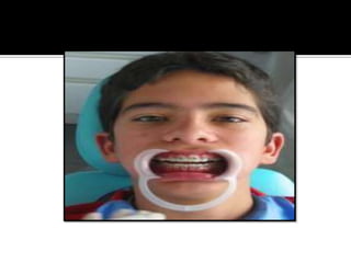 manejopsicologicodelniodiapossitivas-121015195908-phpapp02 (1).pptx