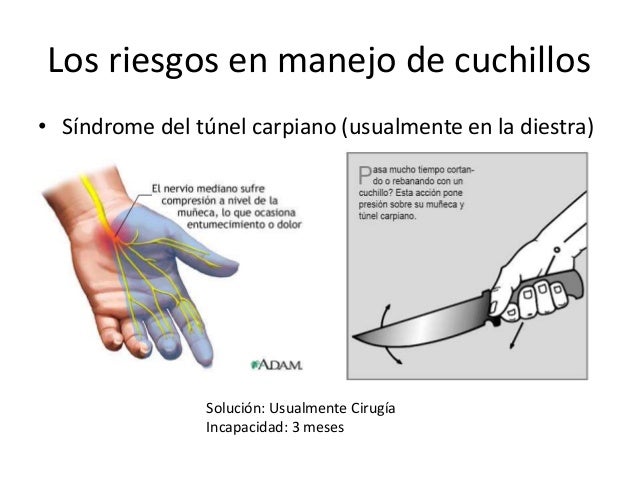 Los riesgos en manejo de cuchillos
â€¢ SÃ­ndrome del tÃºnel carpiano (usualmente en la diestra)

SoluciÃ³n: Usualmente CirugÃ­a
...