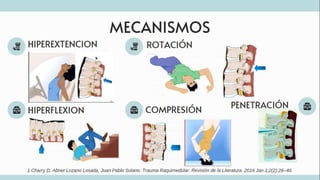 TRAUMATISMO VERTEBROMEDULAR
 