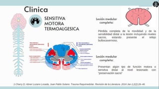 TRAUMATISMO VERTEBROMEDULAR
1.UpToDate [Internet]. www.uptodate.com.
[cited 2024 May 15]. Available from:
https://www.uptodate.com/contents/acute-
traumatic-spinal-cord-
injury?source=history_widget#H5
 