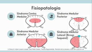 TRAUMATISMO VERTEBROMEDULAR
1.UpToDate [Internet]. www.uptodate.com.
[cited 2024 May 15]. Available from:
https://www.uptodate.com/contents/acute-
traumatic-spinal-cord-
injury?source=history_widget#H5
 