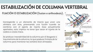 ESTABILIZACIÓN DE COLUMNA VERTEBRAL
Corresponde a un elemento de titanio que unen una
vértebra con otra, provocando una fusión cuando se
combina con el aporte de injerto óseo actualmente
aportados, esto implica no tener que sacar el injerto de la
cadera o cresta iliaca.
Se produce inestabilidad de la columna por el desgaste o
traumatismo de la columna, lo que produce firmeza de la
columna para mantener las vertebra bien alineadas.
FIJACIÓN O ESTABILIZACIÓN (fusion o arthrodesis).
https://www.columna-vertebral.cl/fijacion-y-estabilizacion-de-columna/
 