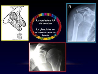Manejo tx ms ss 2 | PPT