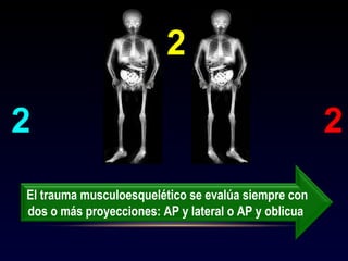 2 2
2
El trauma musculoesquelético se evalúa siempre con
dos o más proyecciones: AP y lateral o AP y oblicua
 
