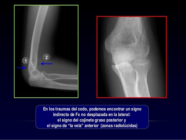manejo-tx-ms-ss-2